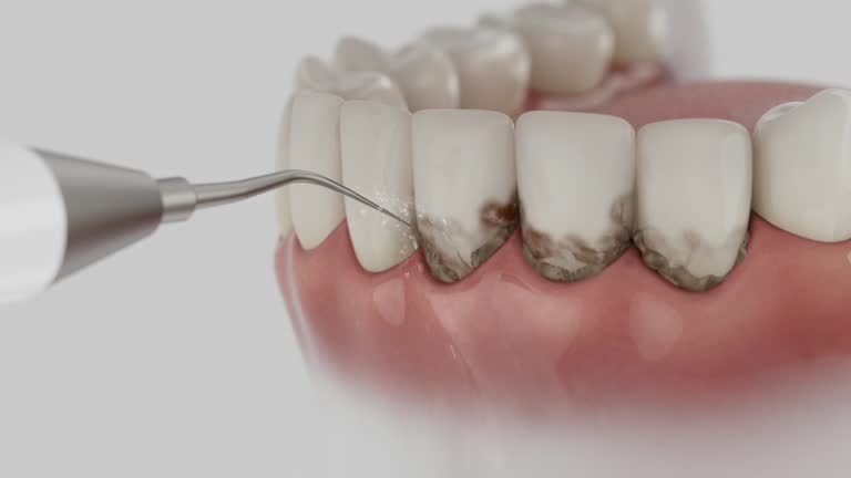 Reliable Dental contractor in Centralia, MO by Smile Center Dentistry